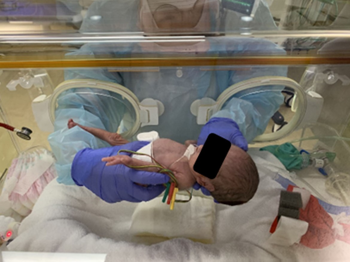 豚衡機による計測