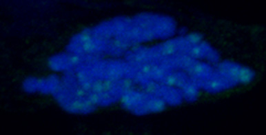 染色体（青色）上のDNA2本鎖切断部分（緑色の点）を検出
